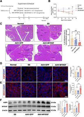 Myeloid-derived growth factor promotes M2 macrophage polarization and attenuates Sjögren’s syndrome via suppression of the CX3CL1/CX3CR1 axis